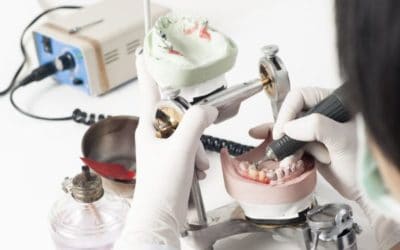 Choosing Between CEREC and Traditional Crowns