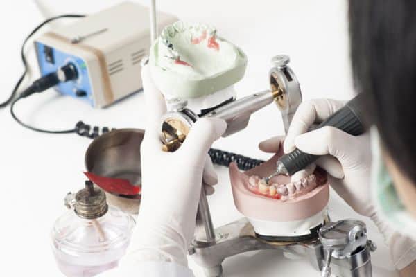 Choosing Between CEREC and Traditional Crowns