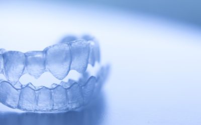 Reasons To Visit Your Invisalign® Dentist in Scottsdale