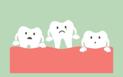 What Age Should I Consider a Wisdom Tooth Extraction?