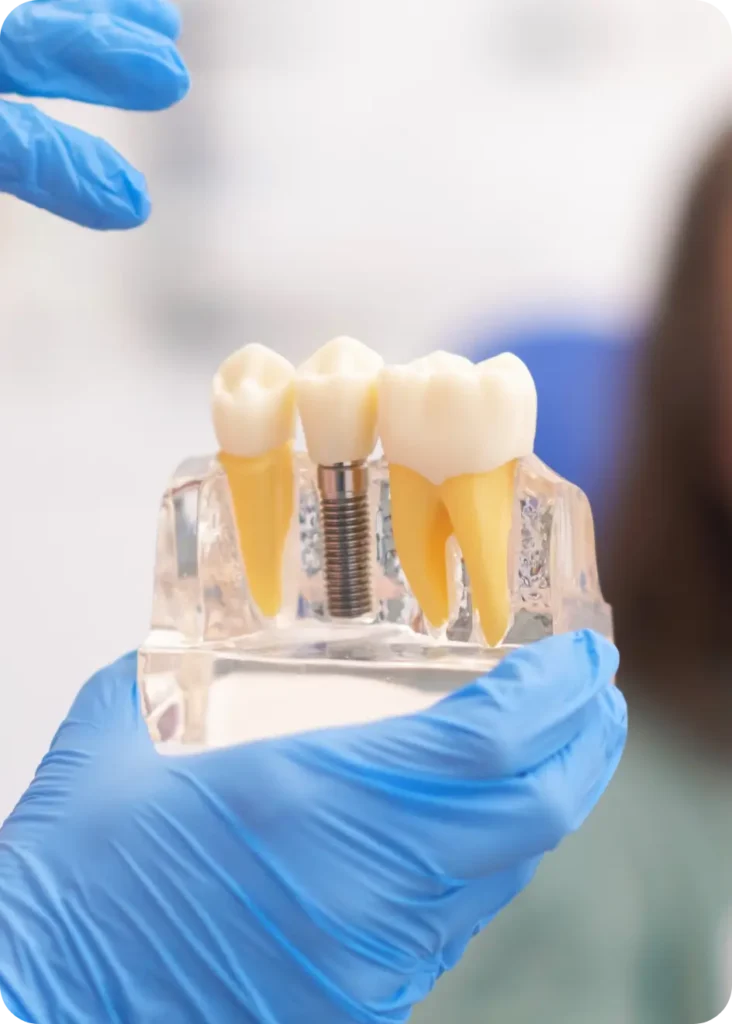 Close up of dental model with implant