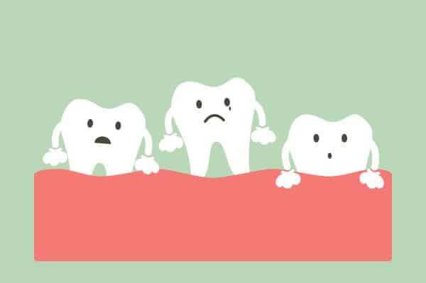 What Age Should I Consider a Wisdom Tooth Extraction?